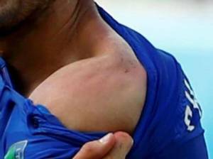 Chiellini shows off the bite mark  (Image from Getty)