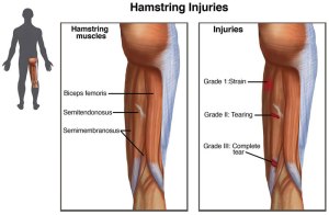 Hamstring injuries are common in football (Image from Wikipedia)