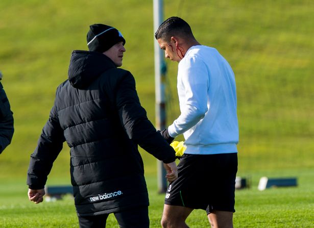 Izaguirre leaves training to get stitches for his cut (Image from SNS Group)